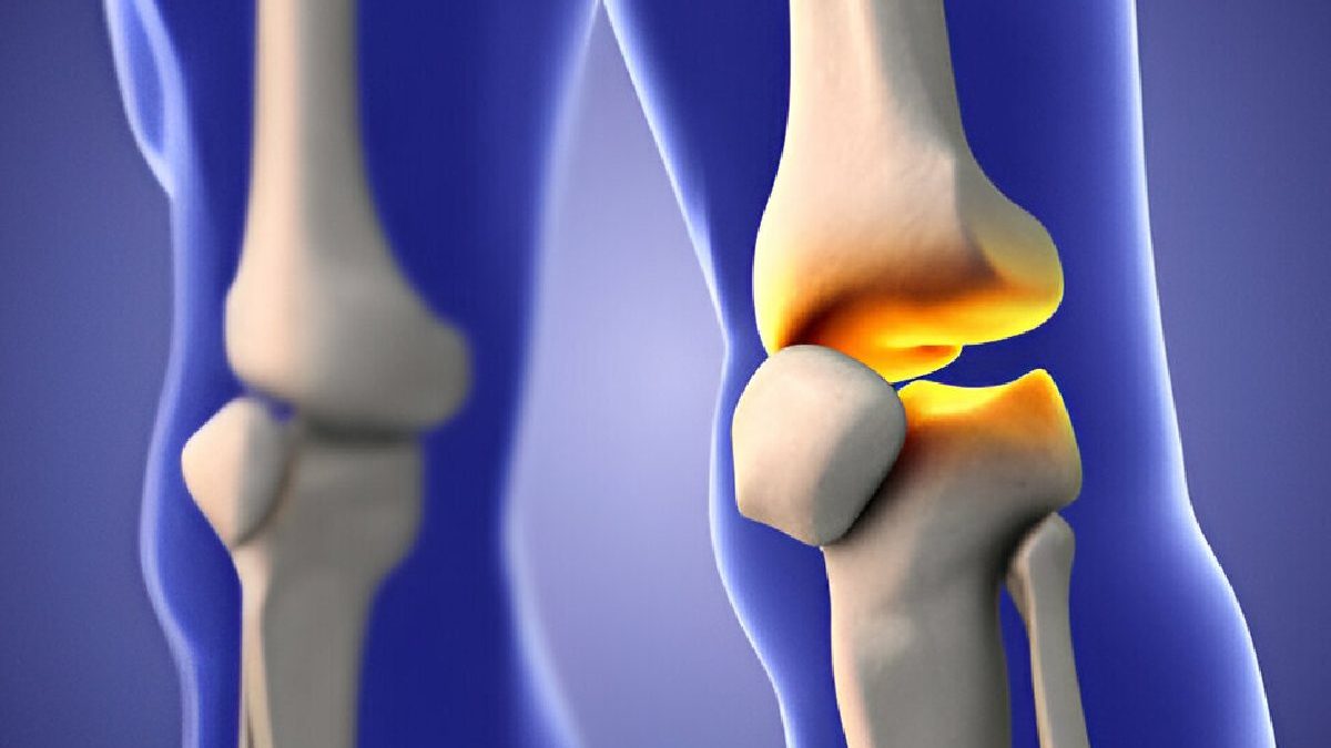 What is a Bone Fracture? – Causes, Types, Symptoms, and More